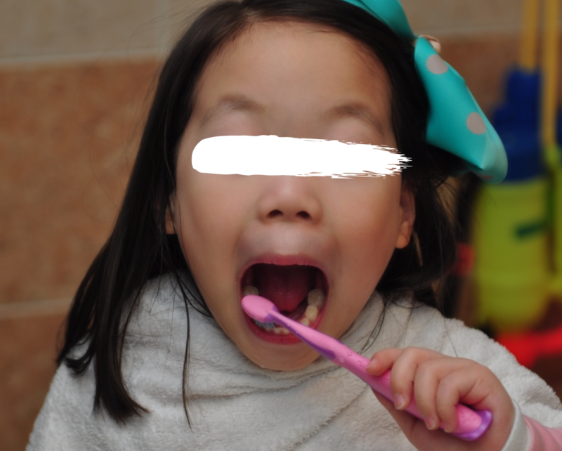 치과 통증, 안 아프게 치료 받는 법_치과마취주사/치과 무통 마취_치과 안아프게 치료 할 수 있을까? 사진 6