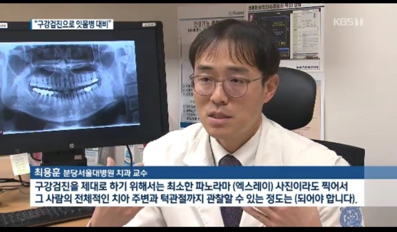 뉴스에서도 강조하는 치주질환 구강검진의 중요성_구강검진시기_잇몸병 예방하자_풍치 증상_풍치 예방