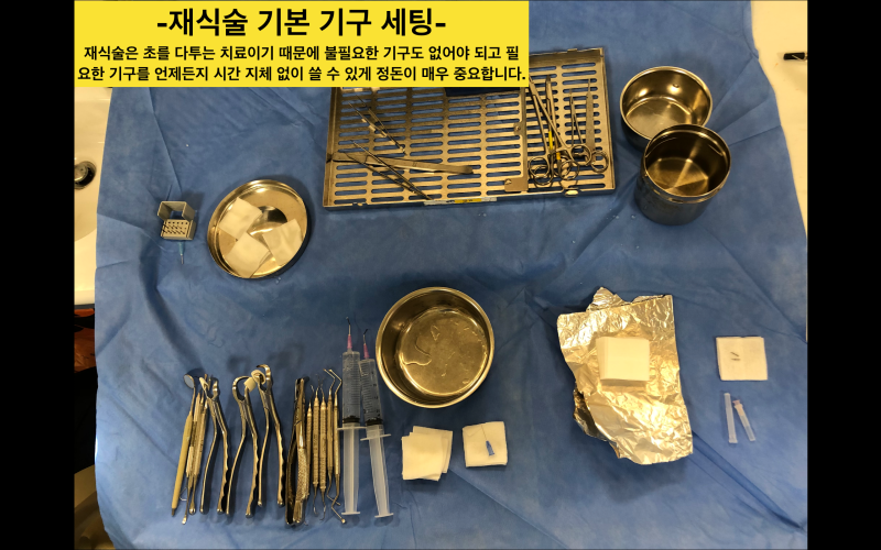 치아재식술_당서울대병원 치과 최용훈교수, 임플란트 하기 전에 꼭 확인해야할 의도적 재식술 1탄 사진 8
