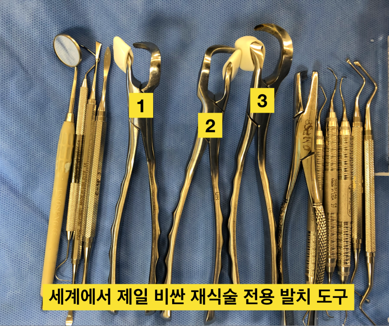 치아재식술_당서울대병원 치과 최용훈교수, 임플란트 하기 전에 꼭 확인해야할 의도적 재식술 1탄 사진 9