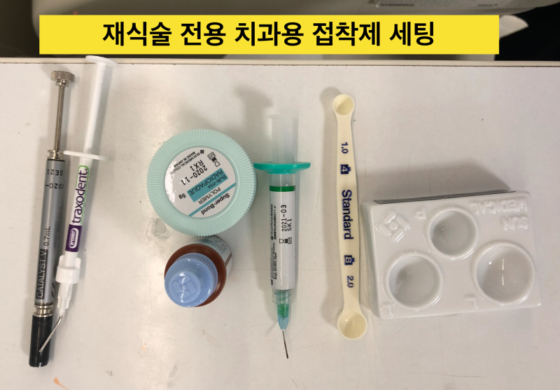 치아재식술_당서울대병원 치과 최용훈교수, 임플란트 하기 전에 꼭 확인해야할 의도적 재식술 1탄 사진 10