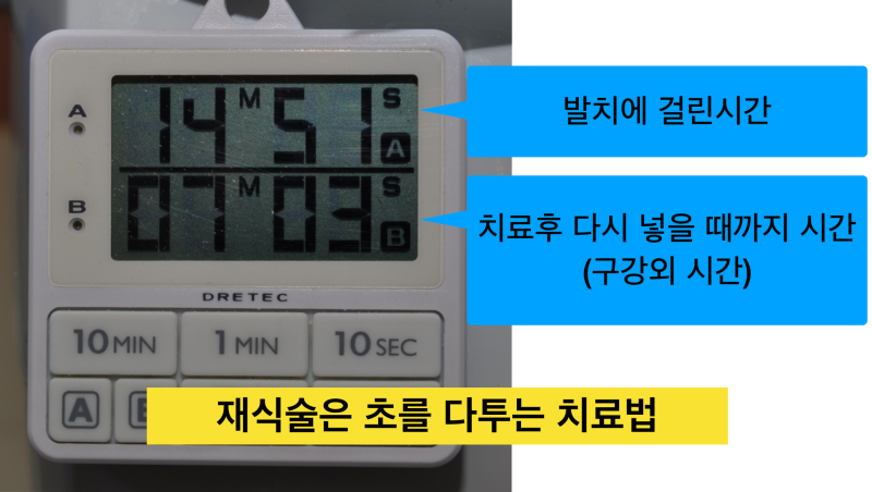 치아재식술_당서울대병원 치과 최용훈교수, 임플란트 하기 전에 꼭 확인해야할 의도적 재식술 1탄