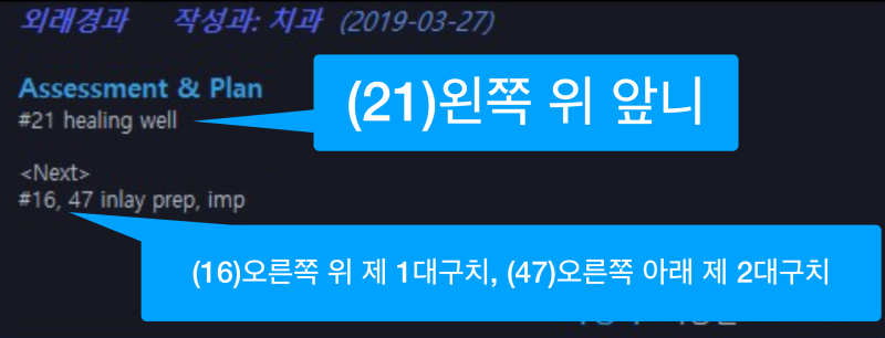 치과에서 호갱 NONO! 치아번호 알고가서 꼼꼼하게 치과진료받기 사진 8
