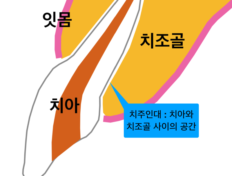 치과마취 안아프게 치료받는 꿀팁! 치과마취통증 없이~ 치주인대마취 알고가기
