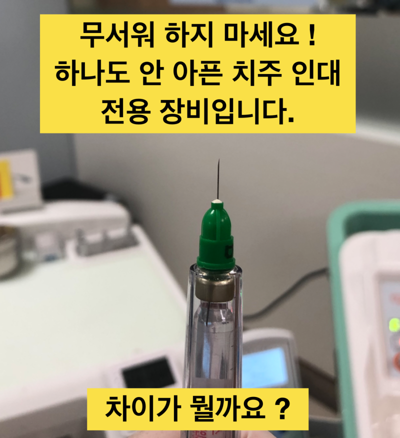 [안아프게마취/치과치료안아프게] 치주인대마취 장비와 방법 사진 2