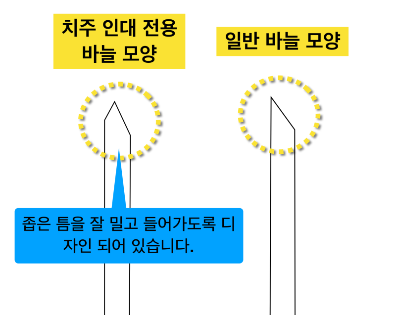 [안아프게마취/치과치료안아프게] 치주인대마취 장비와 방법 사진 3