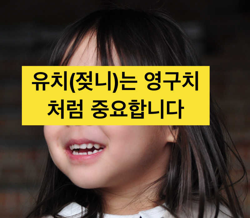 유치갯수, 유치 치아번호를 알아보자 (치과의료사고 예방, 영구치와 유치 혼동 주의 !) 사진 2