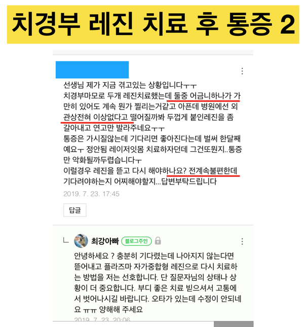 [치경부 파임/치경부마모증]으로 인한 치경부 치료 레진 실패, 치경부 레진 통증 해결법 사진 2