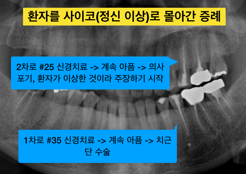 [치과 의료사고/치과오진의 비극] 치과치료후에도 계속 아프다면? 치아치료의 핵심은 진단이다