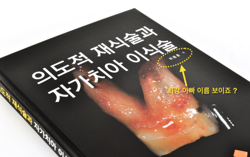 치아재식술 가능한 경우와 불가능한 경우, 나는 의도적재식술 치료가 가능할까?