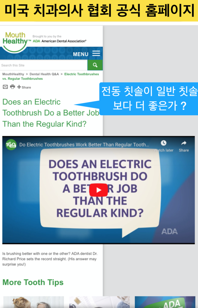 치과의사는 전동칫솔 추천할까? 일반칫솔vs전동칫솔 효과_ 어떤 것이 더 좋은가요? 사진 2