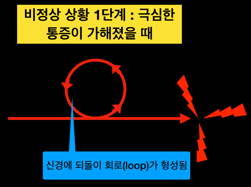 치통트라우마, 치과마취가 중요한 이유! 아프지않게 치과치료를 받아야 하는 이유 치과치료 후에도 아픈, 비정형치통이란? 사진 4