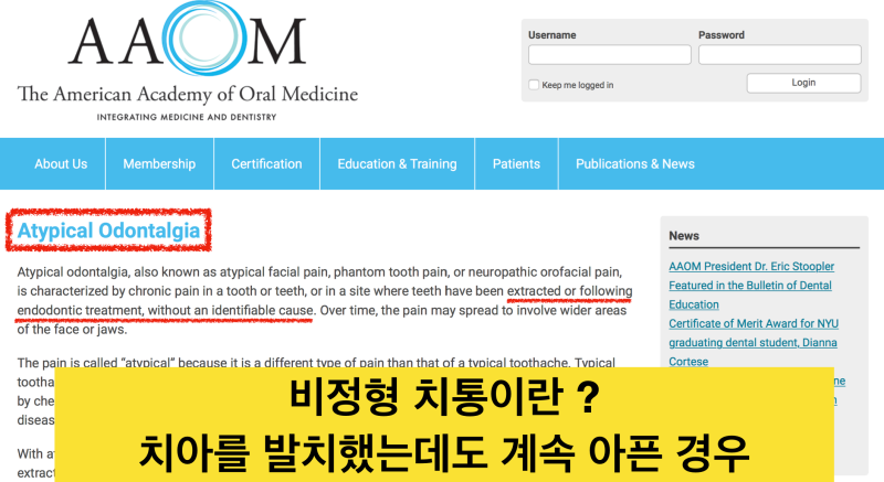 치통트라우마, 치과마취가 중요한 이유! 아프지않게 치과치료를 받아야 하는 이유 치과치료 후에도 아픈, 비정형치통이란?