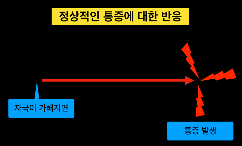 치통트라우마, 치과마취가 중요한 이유! 아프지않게 치과치료를 받아야 하는 이유 치과치료 후에도 아픈, 비정형치통이란? 사진 3
