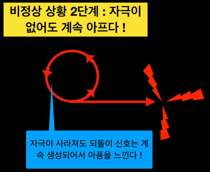 치통트라우마, 치과마취가 중요한 이유! 아프지않게 치과치료를 받아야 하는 이유 치과치료 후에도 아픈, 비정형치통이란? 사진 5