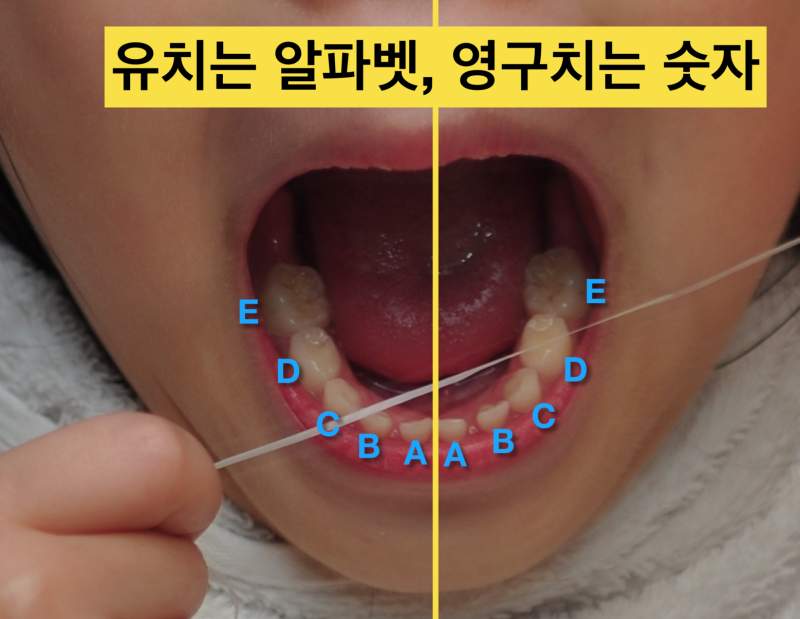 [어린이치과 치아번호] 유치와 영구치를 잘 구분하자 사진 2