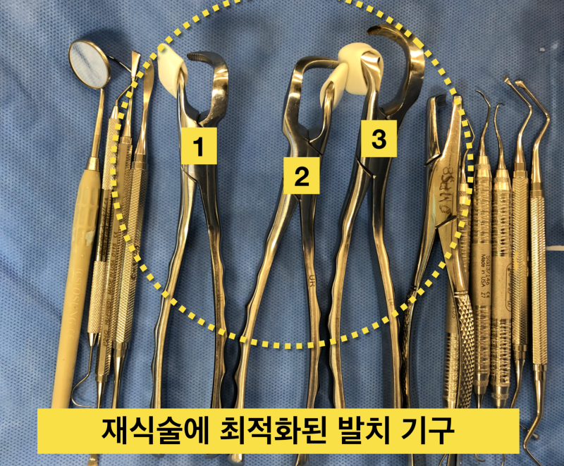 [치아 살리는 재식술]치아 발치의 중요성과 주의점 사진 4
