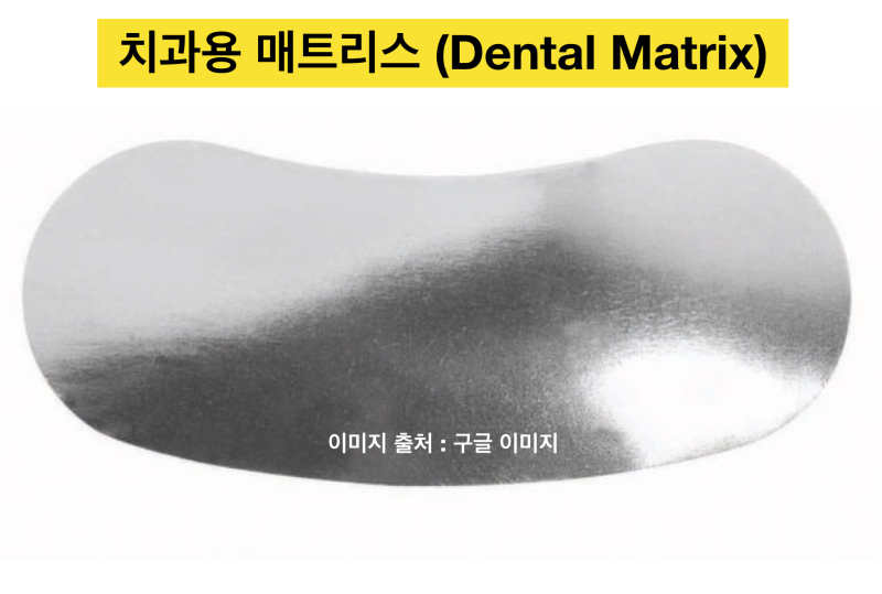 [앞니 레진 치료] 앞니 충치에 매트리스(Matrix)를 써서 옆의 치아를 보호하고 모양은 자연스럽게 레진 치료 하는 방법 사진 2