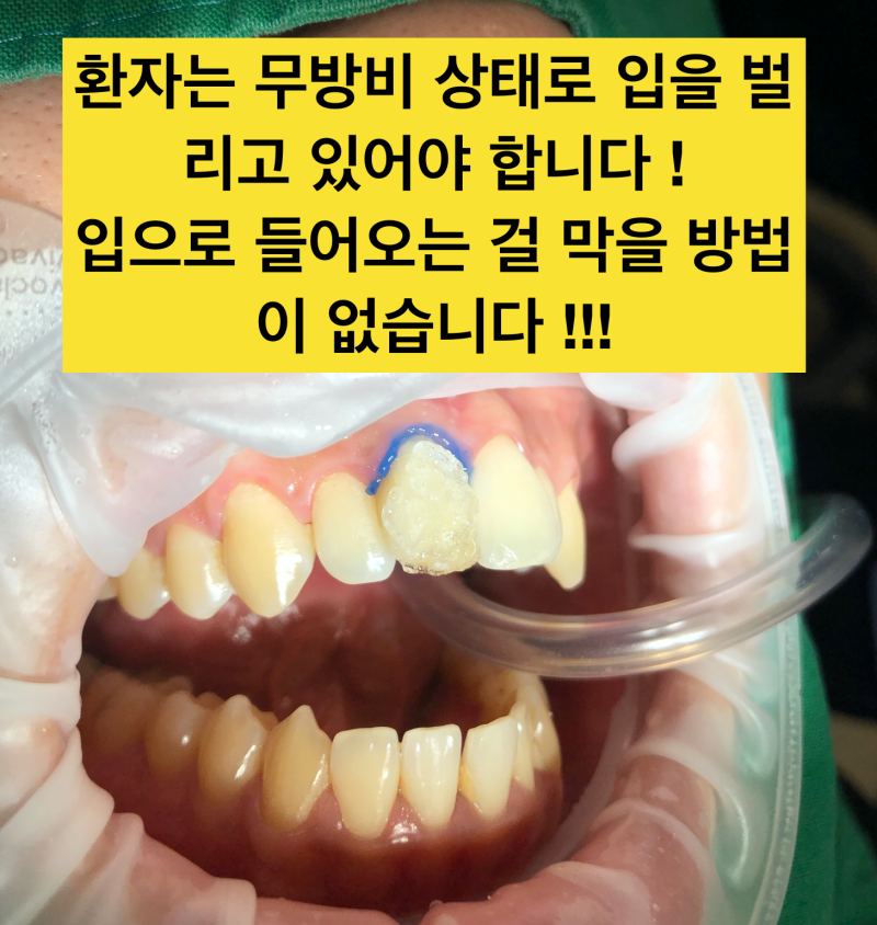 [신종 코로나 예방]치과가 제일 위험하다. 코로나에 제일 취약한 곳이 바로 치과 ! 치과 마스크와 글러브에 대해 알아보자 사진 2