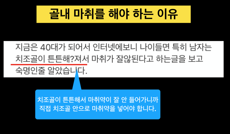 [치과 관계자들 보세요]치과 무통 치료, 안 아프게 치과 마취 받는 방법 사진 3