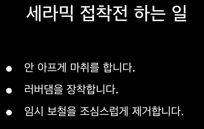 [치과 세라믹 치료] 최강아빠가 접착 세라믹 치료를 선호하는 이유와 접착 과정 2탄