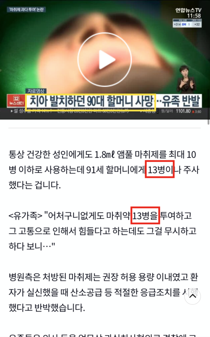[무통 마취를 알아보자] 치과 마취가 안될때, 양보다 질이 중요하다.
