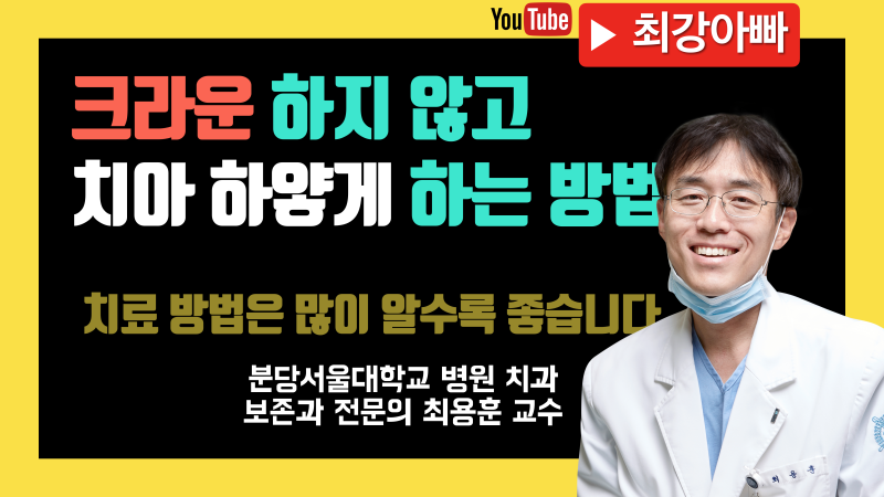 [치아 미백, 앞니 레진] 치아 하나만 변색되었을 때 해결법, 치아가 조금 깨졌을 때는 레진이 좋습니다