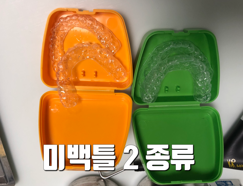 [치아 미백 총정리] 잘 모르시는것, 궁금한 점 정리 사진 3