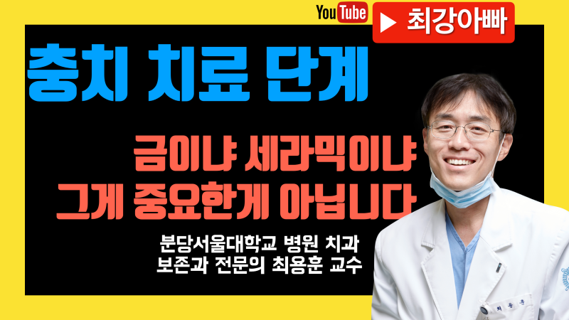 알고나면 단순한 충치(치아 우식증) 치료 단계, 주의 사항