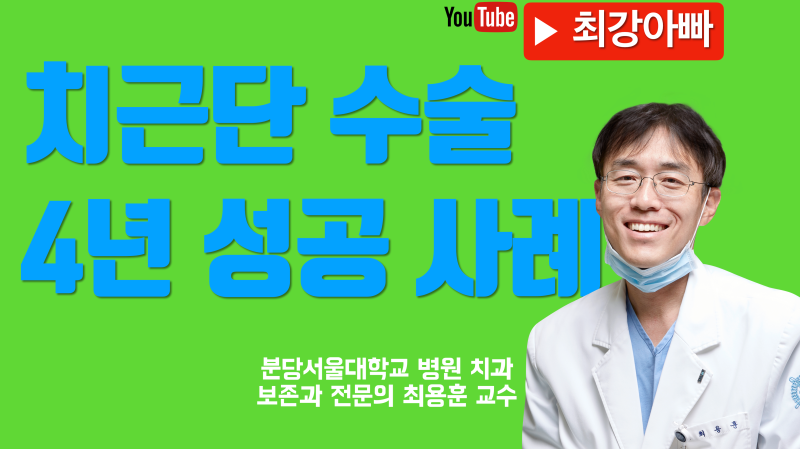 치근 절제술, 치근단 수술 4년 성공 사례