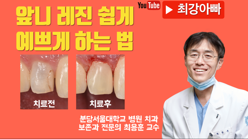 앞니는 크라운보다 레진을 고려해 보세요