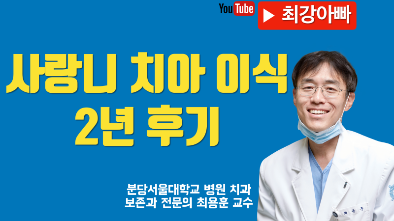 사랑니 자가치아 이식 2년 후기