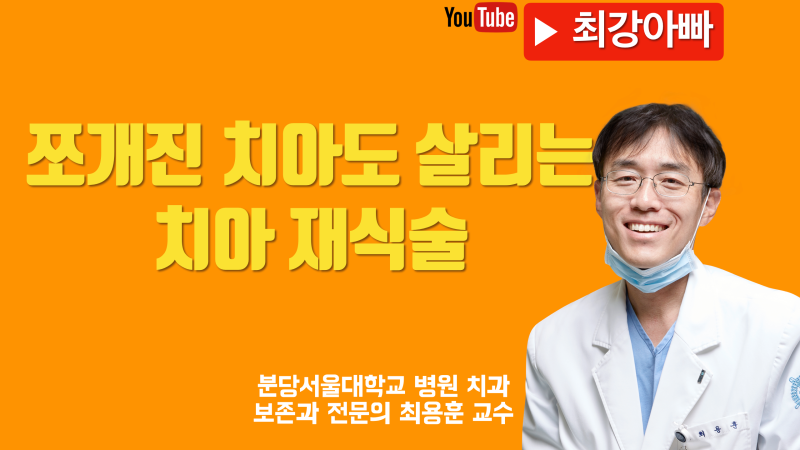 치아 재식술 이것까지 가능합니다