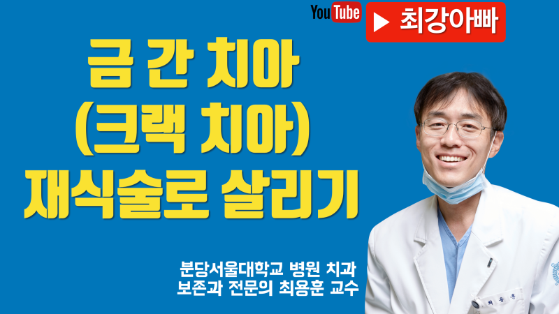 크랙 치아 치아 재식술 치료