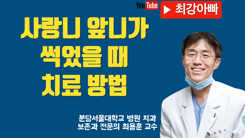 사랑니 앞니가 왕창 썩어서 빼야 한다고 할 때 해결 방법