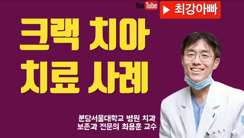 크랙 치아 치료 실제 사례