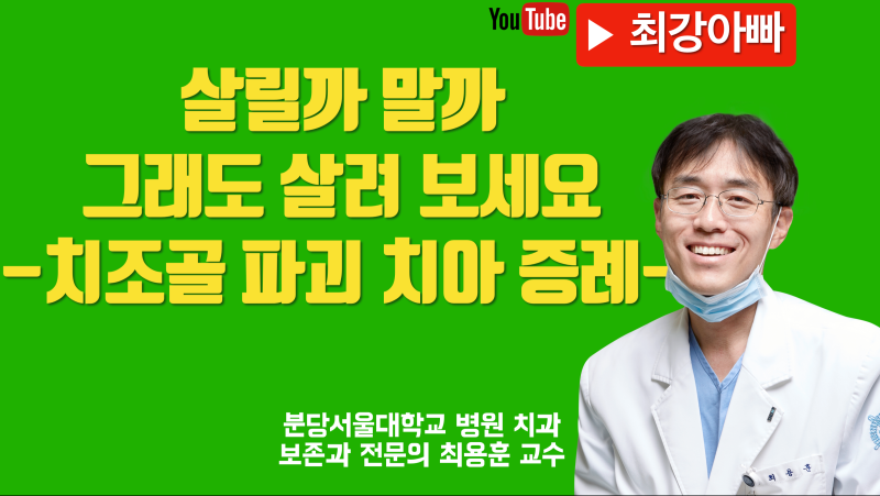 치아 살릴 가능성 있으면 그래도 시도해 보세요