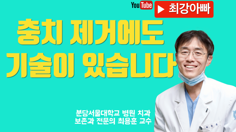 충치 제거 무조건 하면 안됩니다 (Peripheral Sealing)