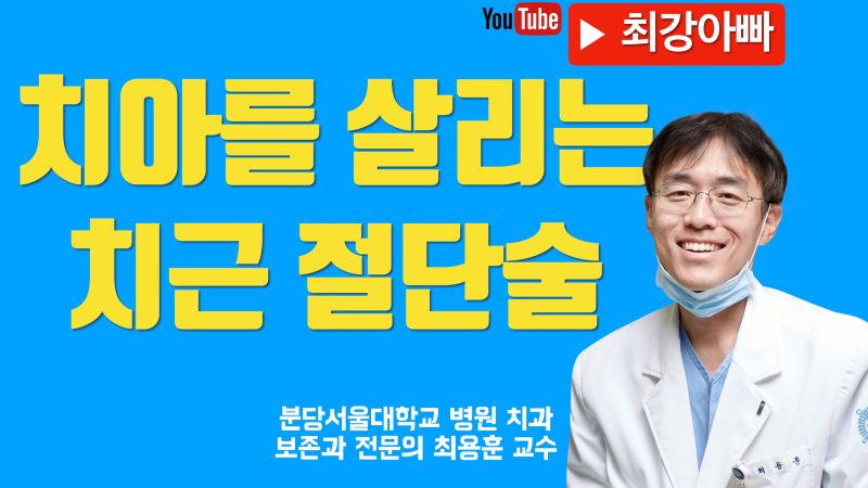 치아를 살리는 치근 절단술 (Root Amputation)