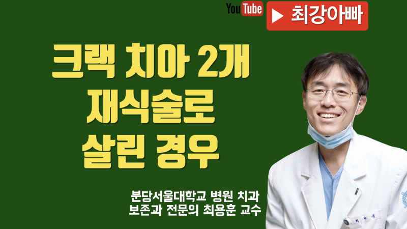 크랙 치아 재식술 치료 증례