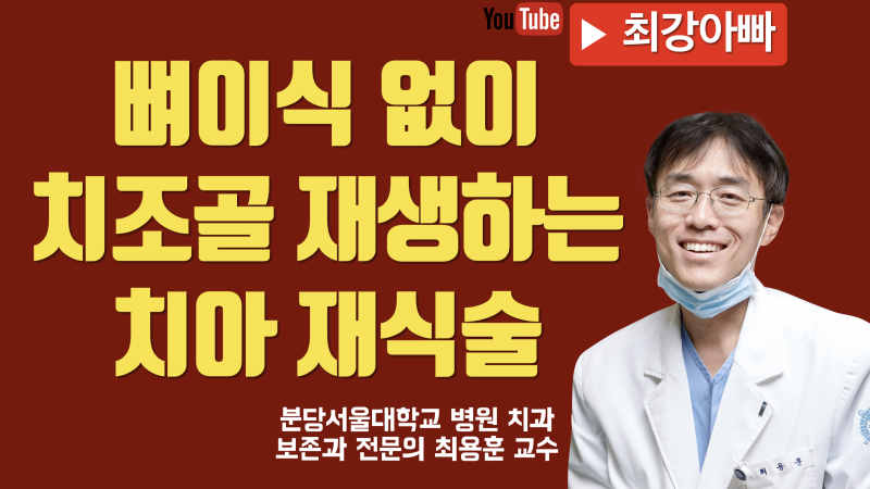 의도적 재식술의 위력 : 치조골 재생 직접 확인 하세요
