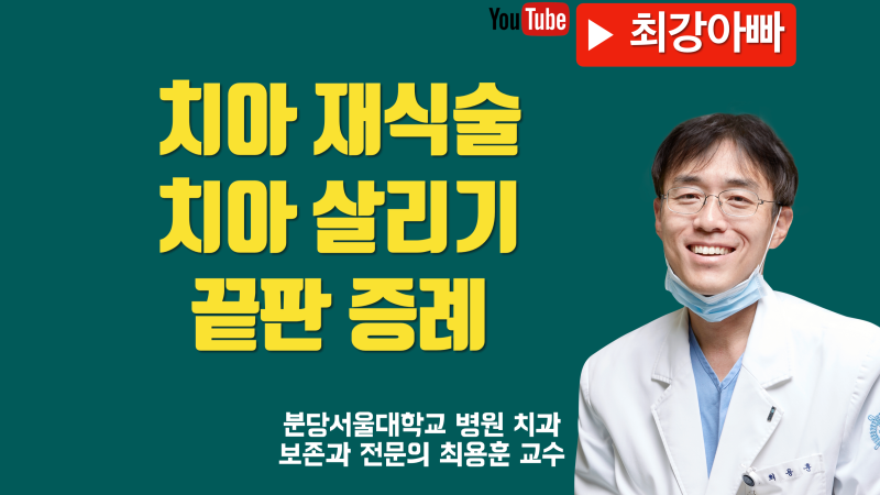 재식술 치아 살리기의 실제, 이런 치아까지 살렸습니다