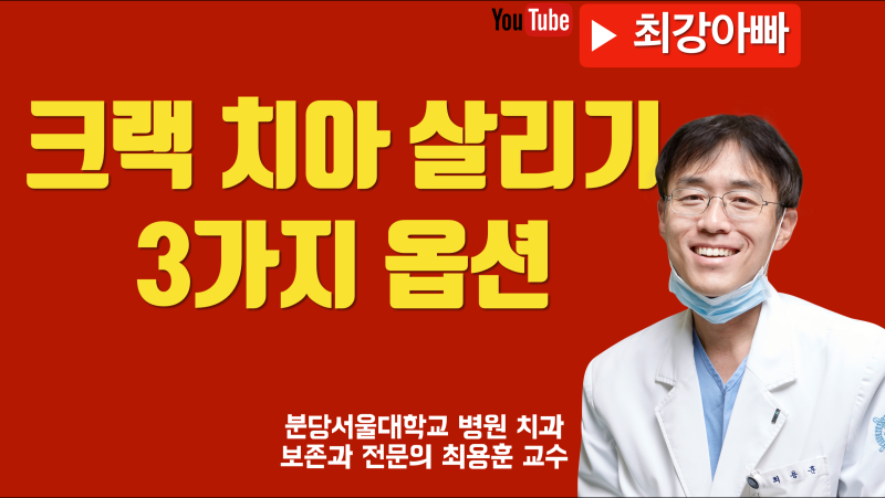 금 간 치아의 3가지 치아 살리기 전략 #크랙치아