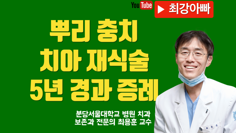 치아 재식술 5년 경과 #치아살리기 #최용훈교수