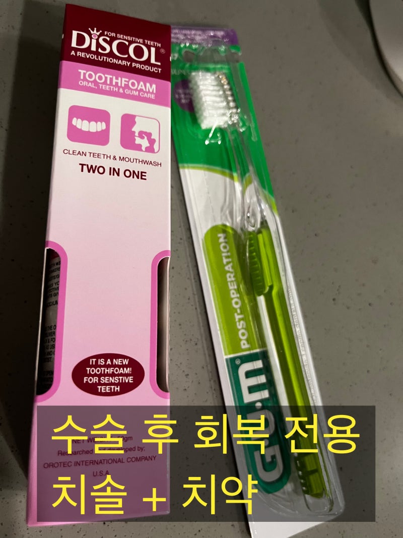 치아 살리기 재식술, 사랑니 이식술 마지막 퍼즐이 완성되고 있습니다 사진 4