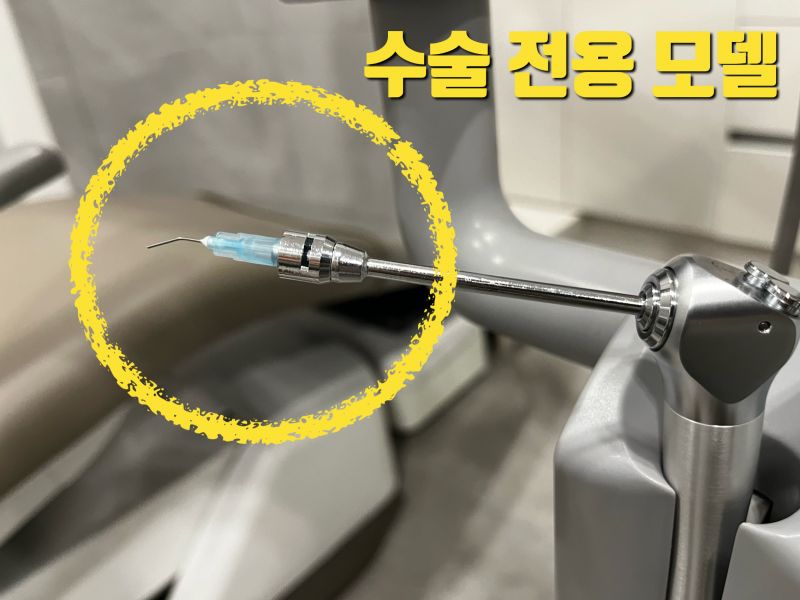 치아 살리기 재식술, 사랑니 이식술 마지막 퍼즐이 완성되고 있습니다 사진 2