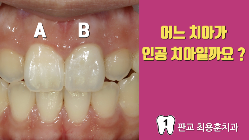 [심미 보철 치료 명의 소개] 마이스터 치과 고여준 원장님