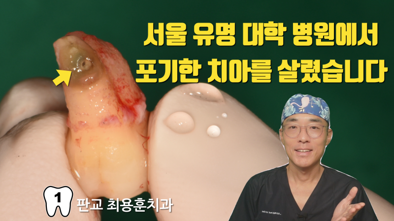 서울에서 포기한 치아 재식술로 살리기