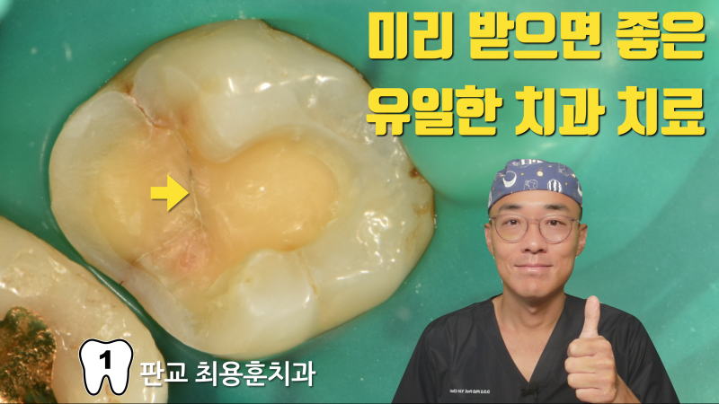 초기 어금니 크렉은 미리 치료하는 걸 추천합니다