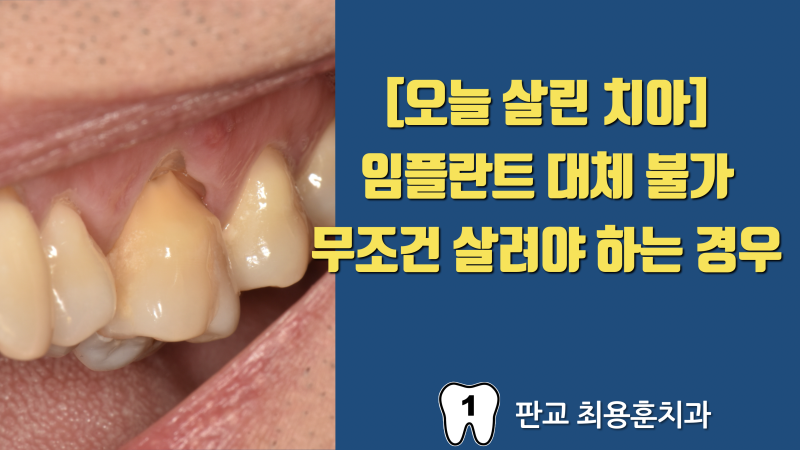 아랫니가 없어서 내려온 치아, 절대로 뽑으면 안되는 경우